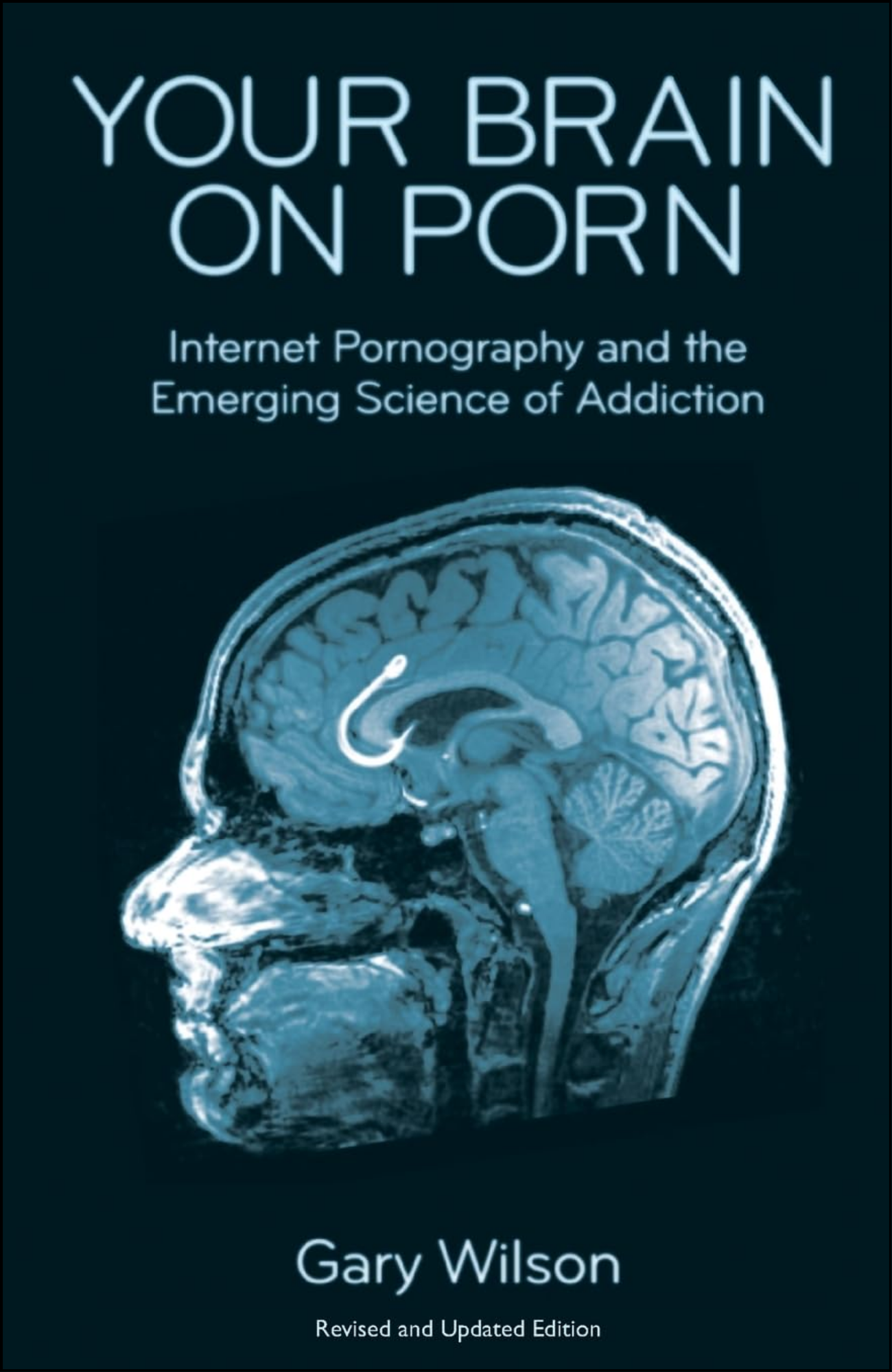 Your Brain on Porn by Gary Wilson (Author)
