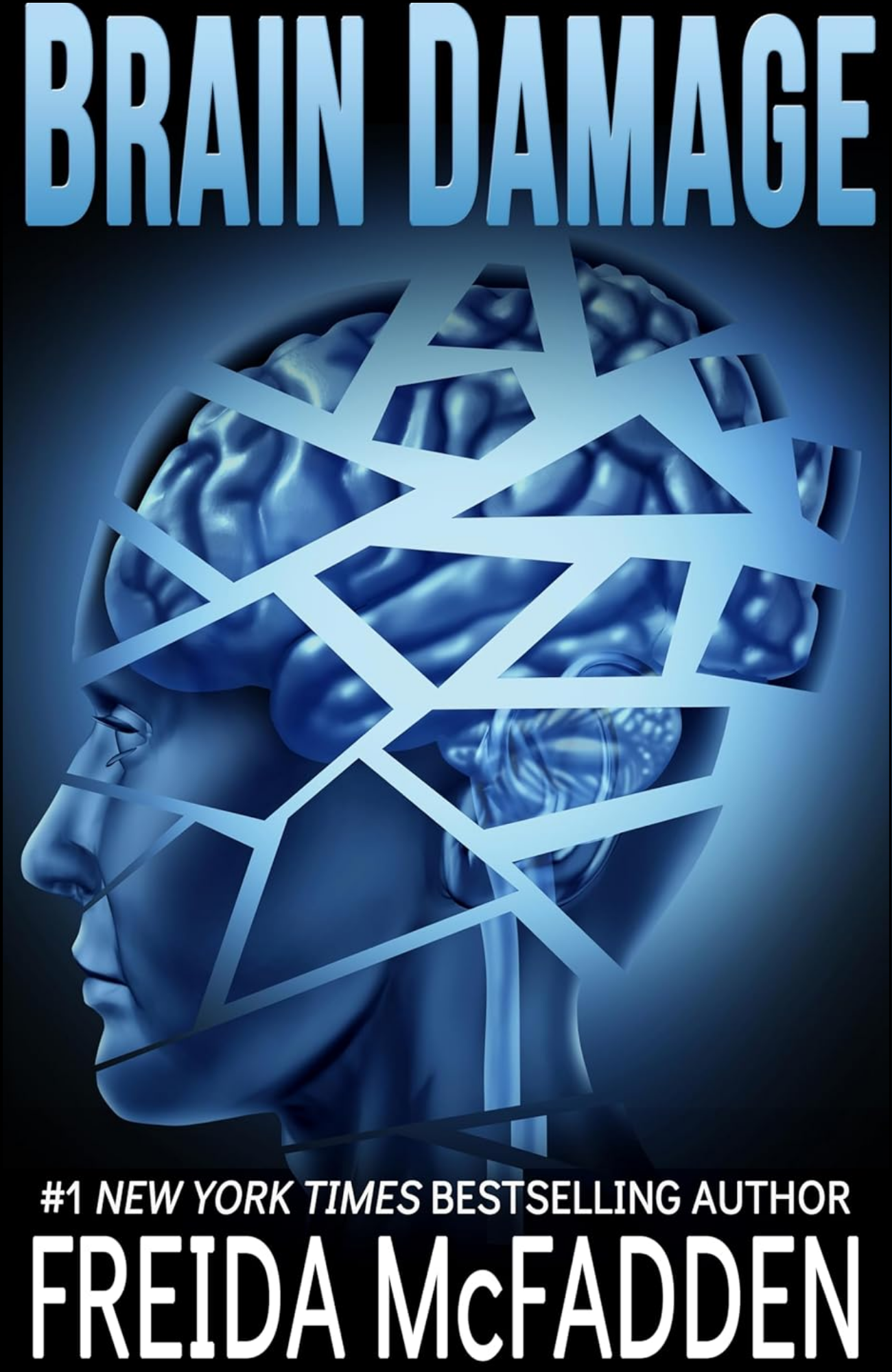 Brain Damage by Freida McFadden (Author)